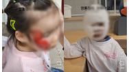[영상]뒤집힌 놀이기구..'세 살배기 쌍둥이' 붕대 '칭칭'