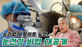 눈에도 찾아오는 변화, 노화 안질환 알아보기 | 닥터톡톡