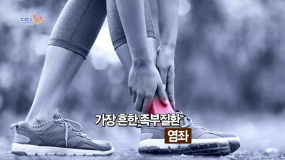 발목염좌 인대파열